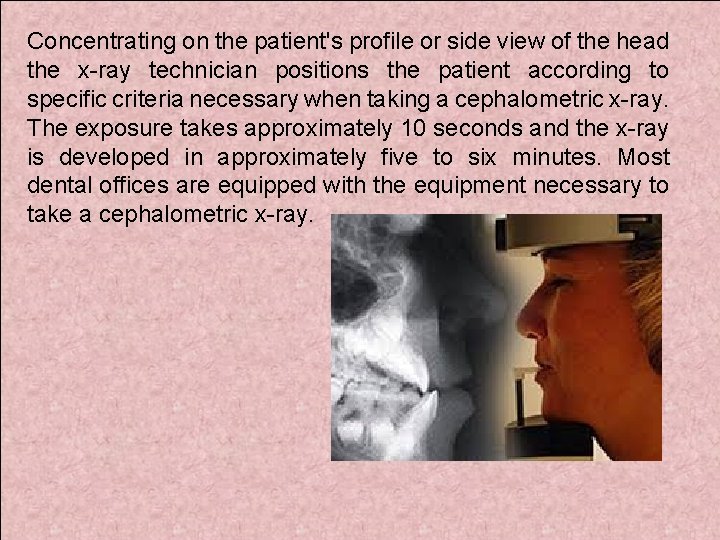 Concentrating on the patient's profile or side view of the head the x-ray technician