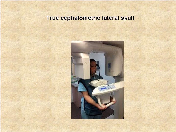 True cephalometric lateral skull 