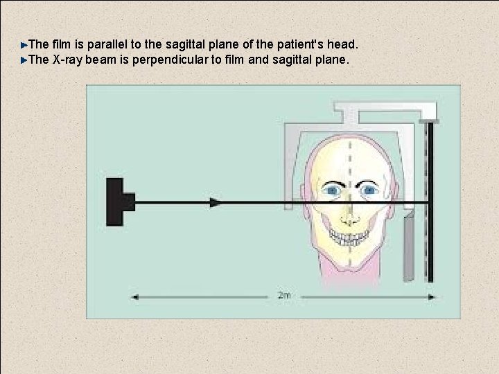 The film is parallel to the sagittal plane of the patient's head. The X-ray