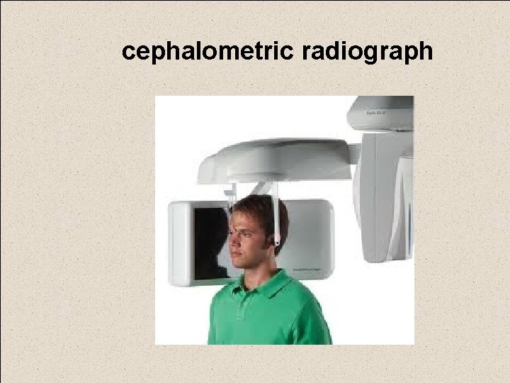 cephalometric radiograph 
