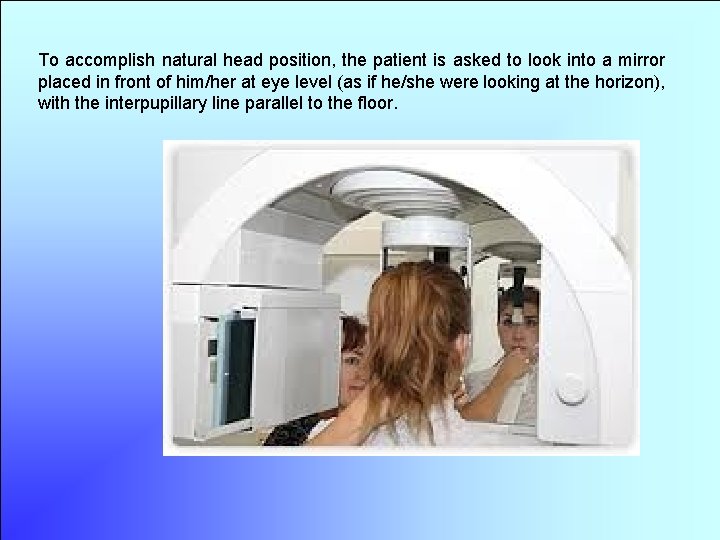 To accomplish natural head position, the patient is asked to look into a mirror