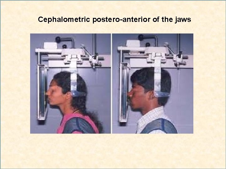 Cephalometric postero-anterior of the jaws 