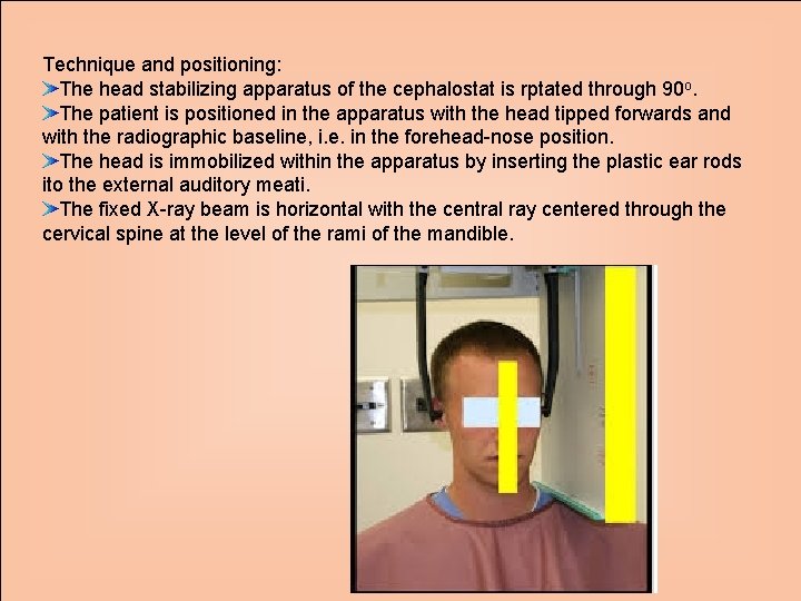 Technique and positioning: The head stabilizing apparatus of the cephalostat is rptated through 90