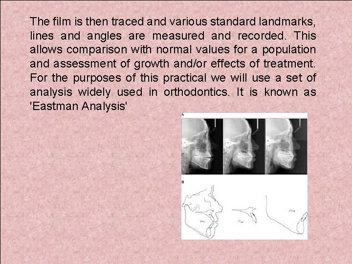 The film is then traced and various standard landmarks, lines and angles are measured