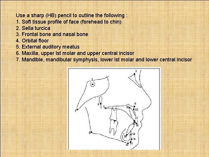 Use a sharp (HB) pencil to outline the following : 1. Soft tissue profile