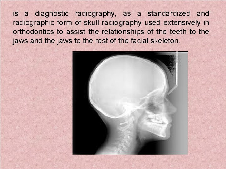 is a diagnostic radiography, as a standardized and radiographic form of skull radiography used