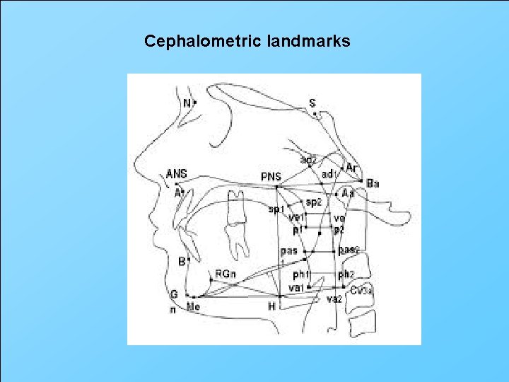 Cephalometric landmarks 