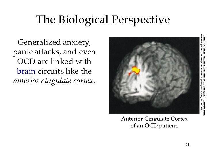 The Biological Perspective Anterior Cingulate Cortex of an OCD patient. 21 S. Ursu, V.