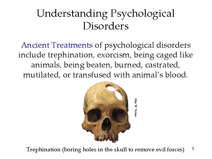 Understanding Psychological Disorders Ancient Treatments of psychological disorders include trephination, exorcism, being caged like