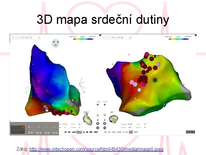 3 D mapa srdeční dutiny Zdroj: http: //www. intechopen. com/source/html/48430/media/image 8. jpeg 