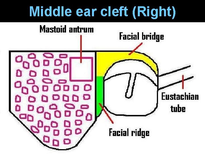 Middle ear cleft (Right) Middle ear cleft (Right)