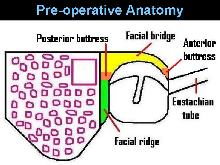 Pre-operative Anatomy Pre-operative Anatomy