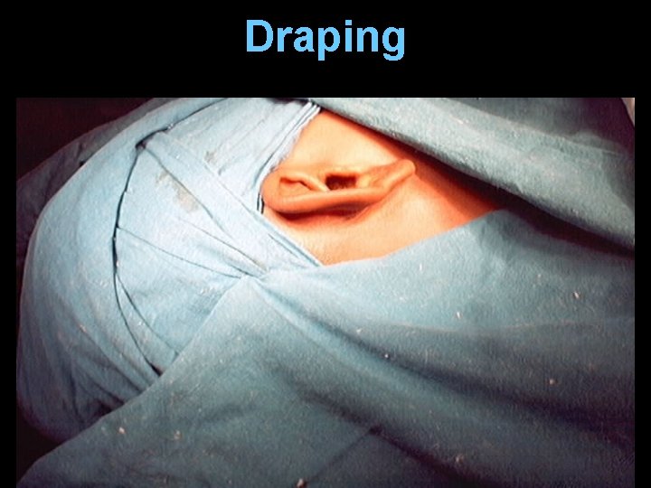 Draping Draping