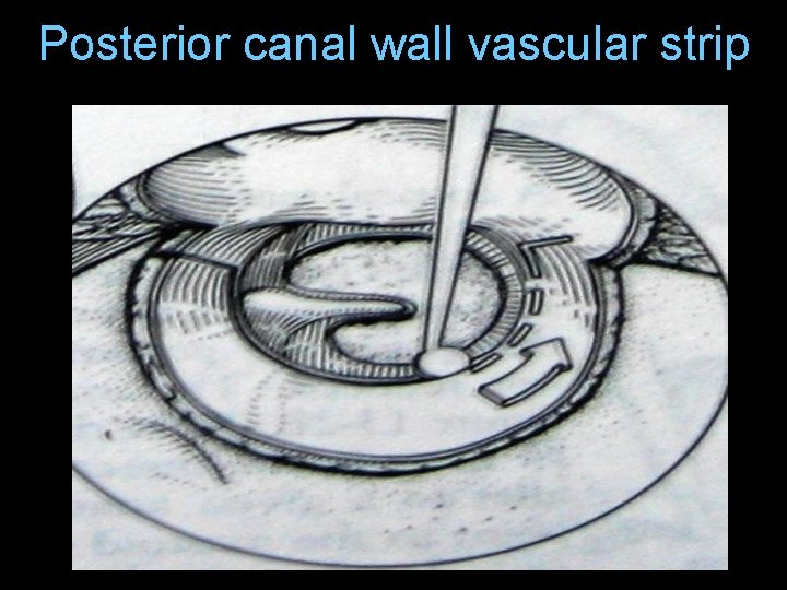Posterior canal wall vascular strip Posterior canal wall vascular strip