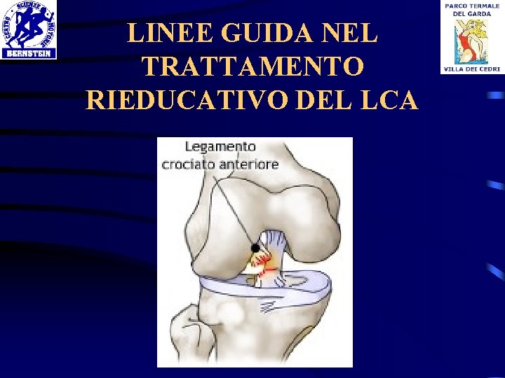 LINEE GUIDA NEL TRATTAMENTO RIEDUCATIVO DEL LCA 