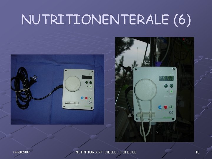 NUTRITIONENTERALE (6) 14/XI/2007 NUTRITION ARIFICIELLE / IFSI DOLE 18 