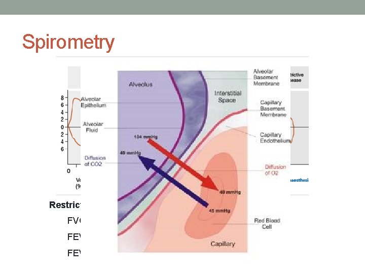 Spirometry Restrictive defect FVC is reduced FEV 1 is reduced in proportion or slightly