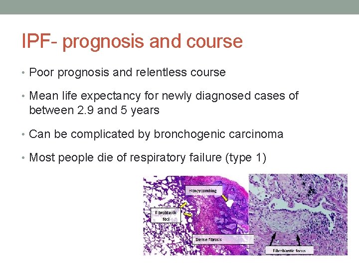 IPF- prognosis and course • Poor prognosis and relentless course • Mean life expectancy