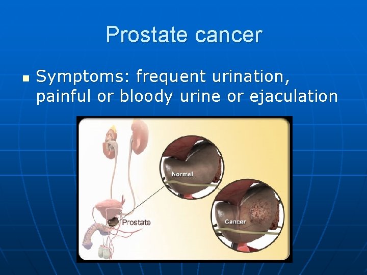 Prostate cancer n Symptoms: frequent urination, painful or bloody urine or ejaculation 