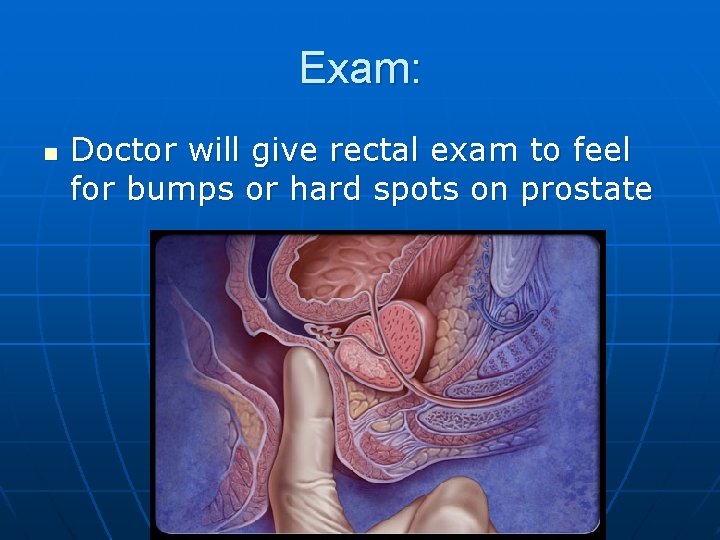 Exam: n Doctor will give rectal exam to feel for bumps or hard spots