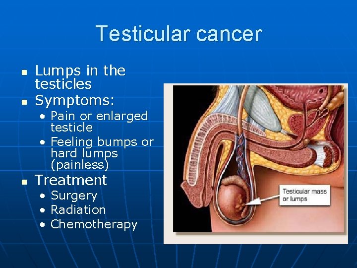 Testicular cancer n n Lumps in the testicles Symptoms: • Pain or enlarged testicle