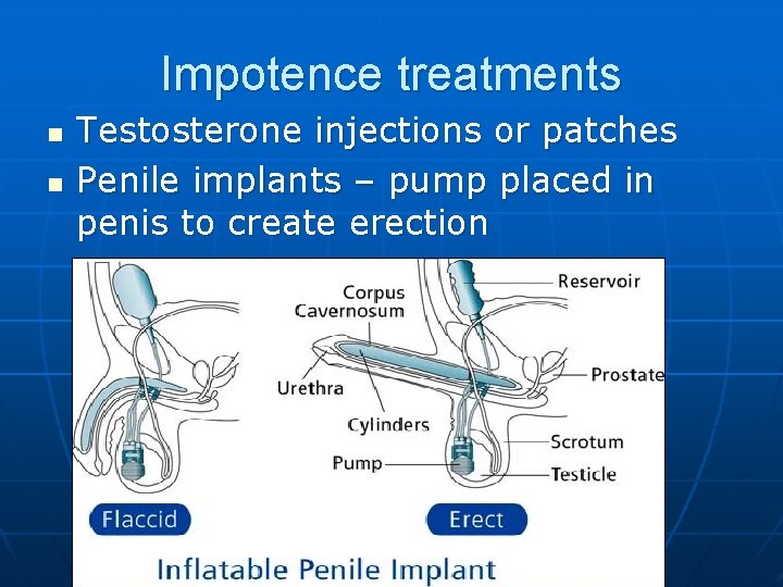 Impotence treatments n n Testosterone injections or patches Penile implants – pump placed in