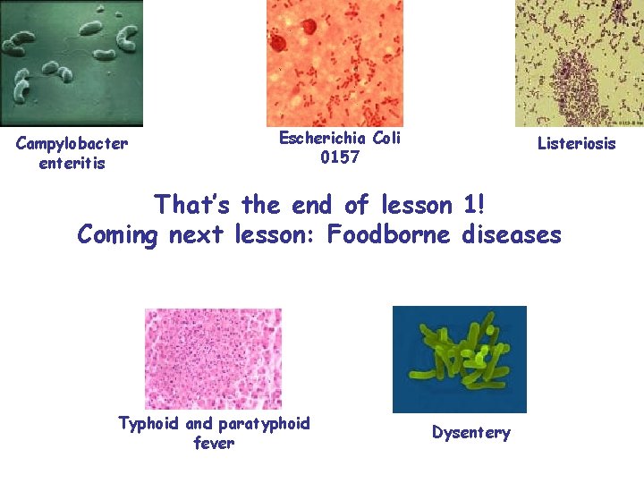 Campylobacter enteritis Escherichia Coli 0157 Listeriosis That’s the end of lesson 1! Coming next