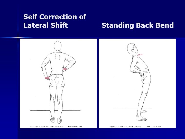 Self Correction of Lateral Shift Standing Back Bend 