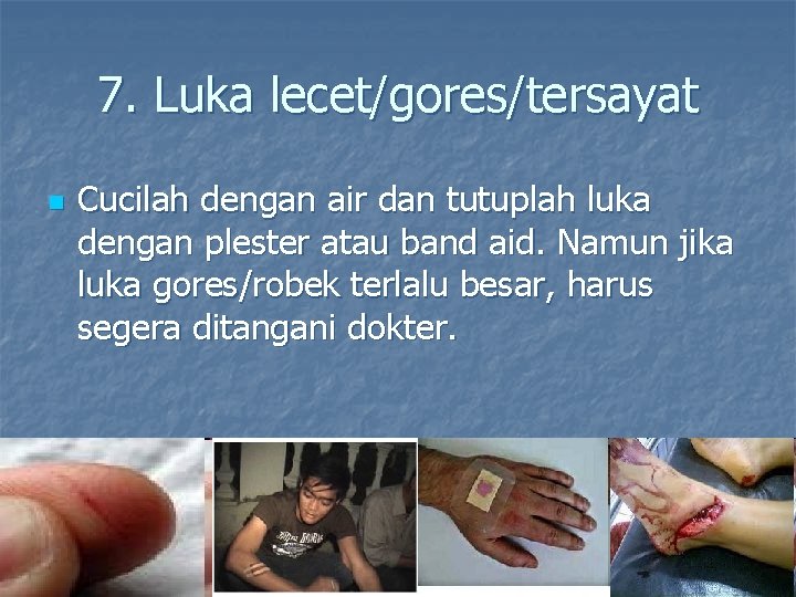 7. Luka lecet/gores/tersayat n Cucilah dengan air dan tutuplah luka dengan plester atau band