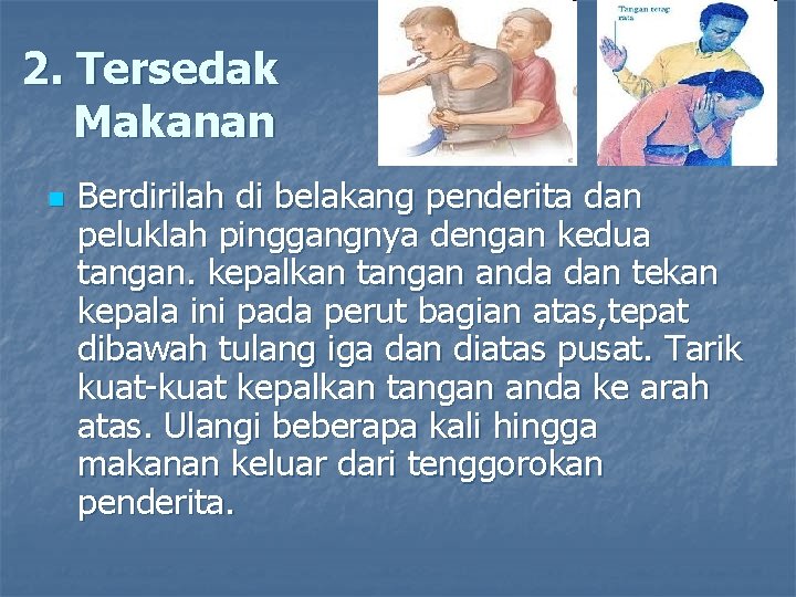 2. Tersedak Makanan n Berdirilah di belakang penderita dan peluklah pinggangnya dengan kedua tangan.