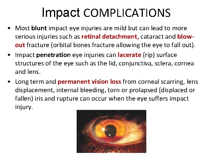 Impact COMPLICATIONS • Most blunt impact eye injuries are mild but can lead to
