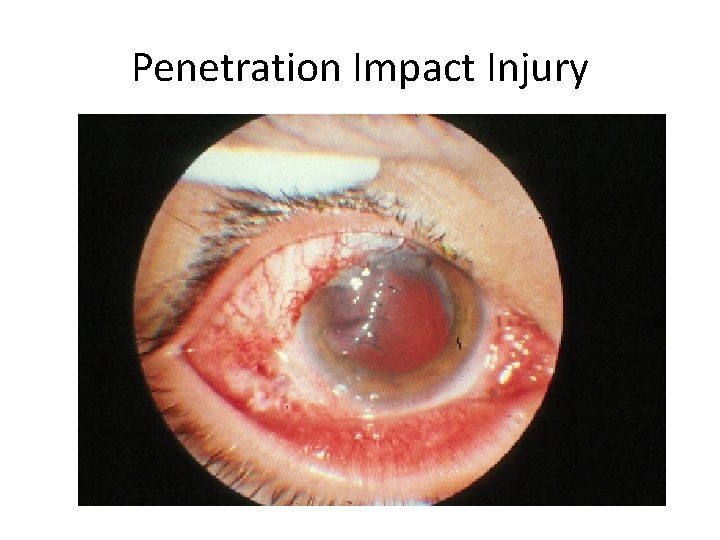 Penetration Impact Injury 