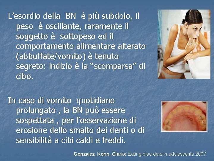 L’esordio della BN è più subdolo, il peso è oscillante, raramente il soggetto è L’esordio della BN è più subdolo, il peso è oscillante, raramente il soggetto è