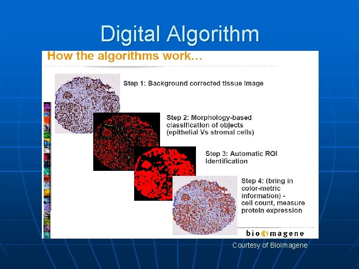 Digital Algorithm Courtesy of Bio. Imagene 