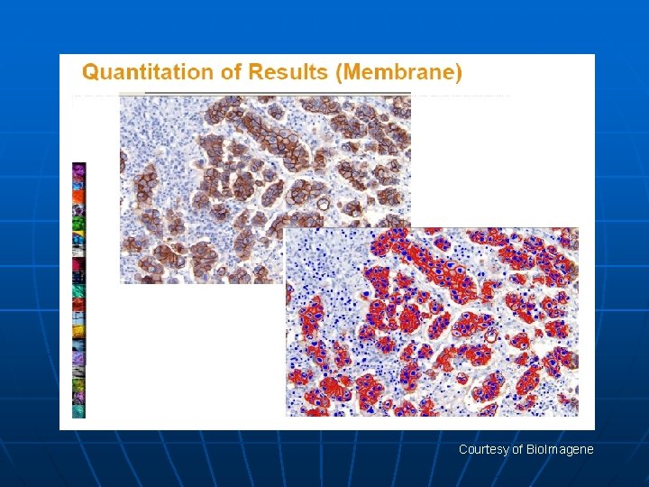 Courtesy of Bio. Imagene 