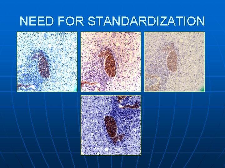 NEED FOR STANDARDIZATION 