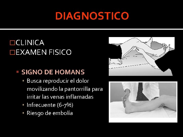 DIAGNOSTICO �CLINICA �EXAMEN FISICO SIGNO DE HOMANS ▪ Busca reproducir el dol 0 r