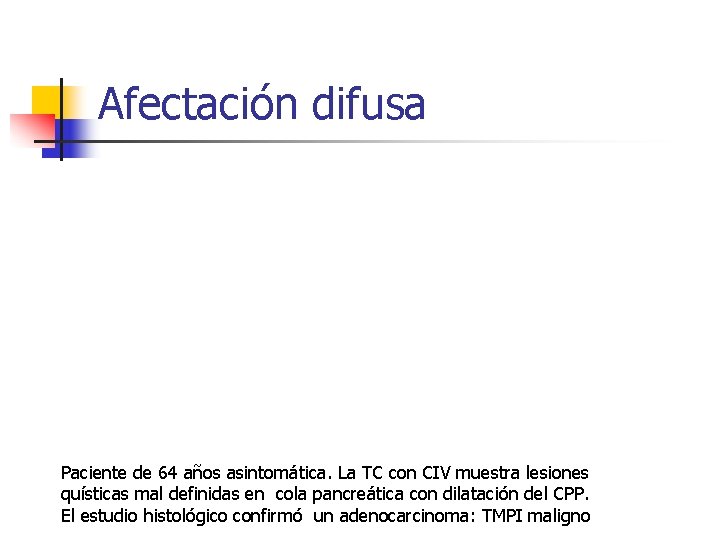 Afectación difusa Paciente de 64 años asintomática. La TC con CIV muestra lesiones quísticas