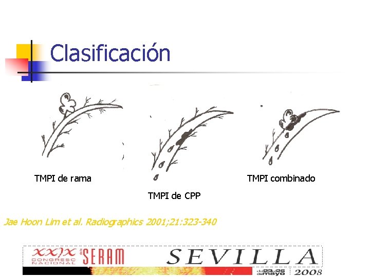 Clasificación TMPI de rama TMPI combinado TMPI de CPP Jae Hoon Lim et al.