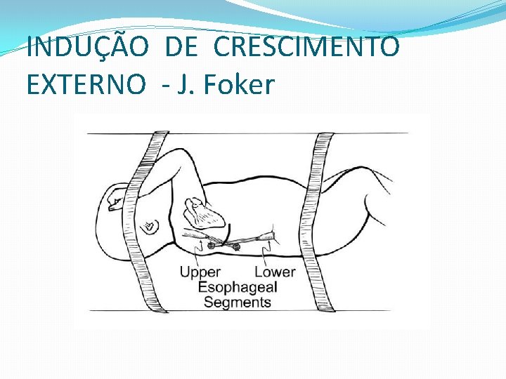 INDUÇÃO DE CRESCIMENTO EXTERNO - J. Foker 