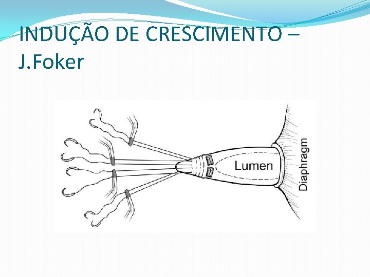 INDUÇÃO DE CRESCIMENTO – J. Foker 