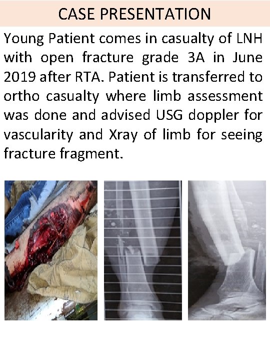 CASE PRESENTATION Young Patient comes in casualty of LNH with open fracture grade 3