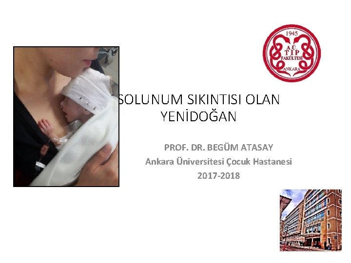 SOLUNUM SIKINTISI OLAN YENİDOĞAN PROF. DR. BEGÜM ATASAY Ankara Üniversitesi Çocuk Hastanesi 2017 -2018