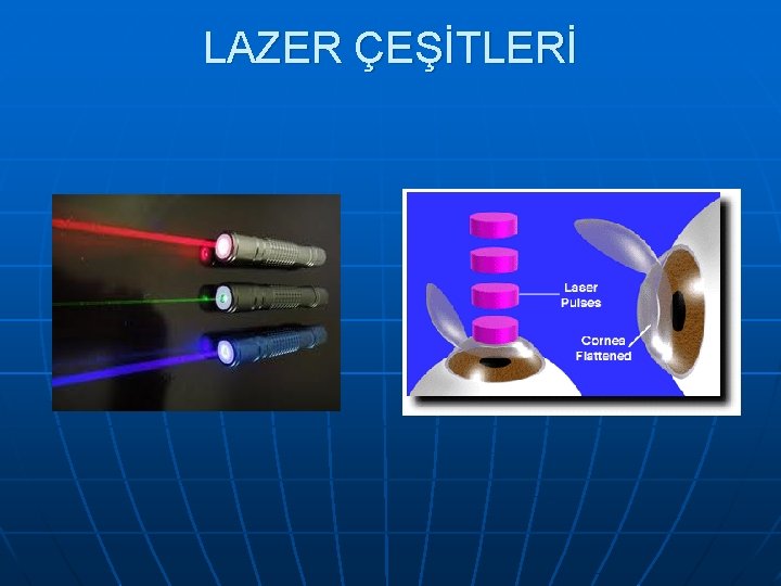 LAZER ÇEŞİTLERİ 