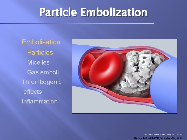 Particle Embolization Embolisation Particles Micelles Gas emboli Thrombogenic effects Inflammation © Josie Stone Consulting