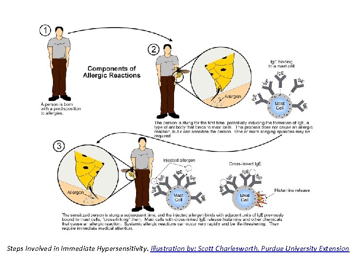 Steps Involved in Immediate Hypersensitivity. Illustration by: Scott Charlesworth, Purdue University Extension 