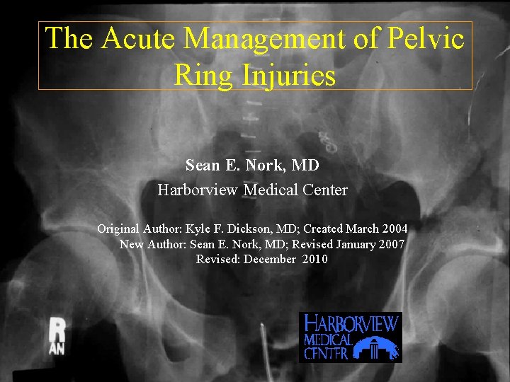 The Acute Management of Pelvic Ring Injuries Sean E. Nork, MD Harborview Medical Center