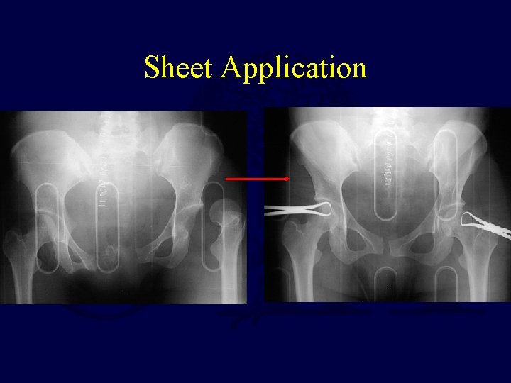 Sheet Application 