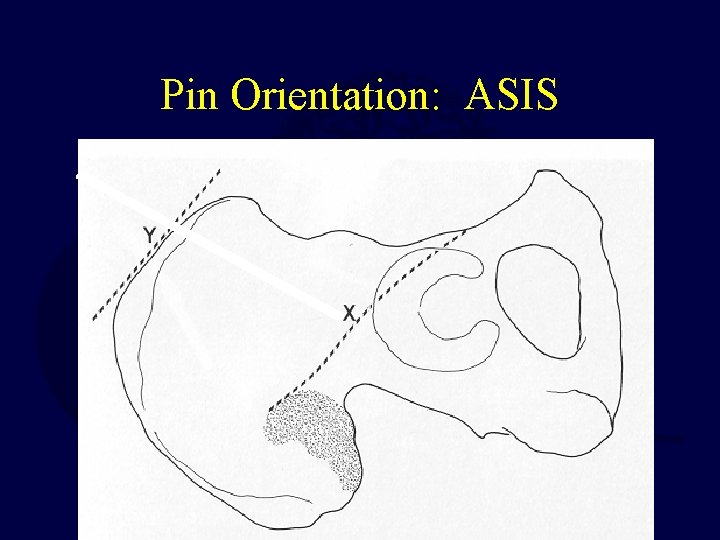 Pin Orientation: ASIS 