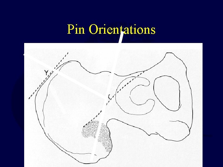 Pin Orientations 